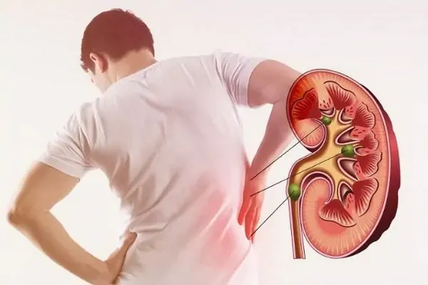 Mức độ Rủi ro ảnh hưởng Gan Thận Tùy thuộc loại "Thuốc giảm cân"